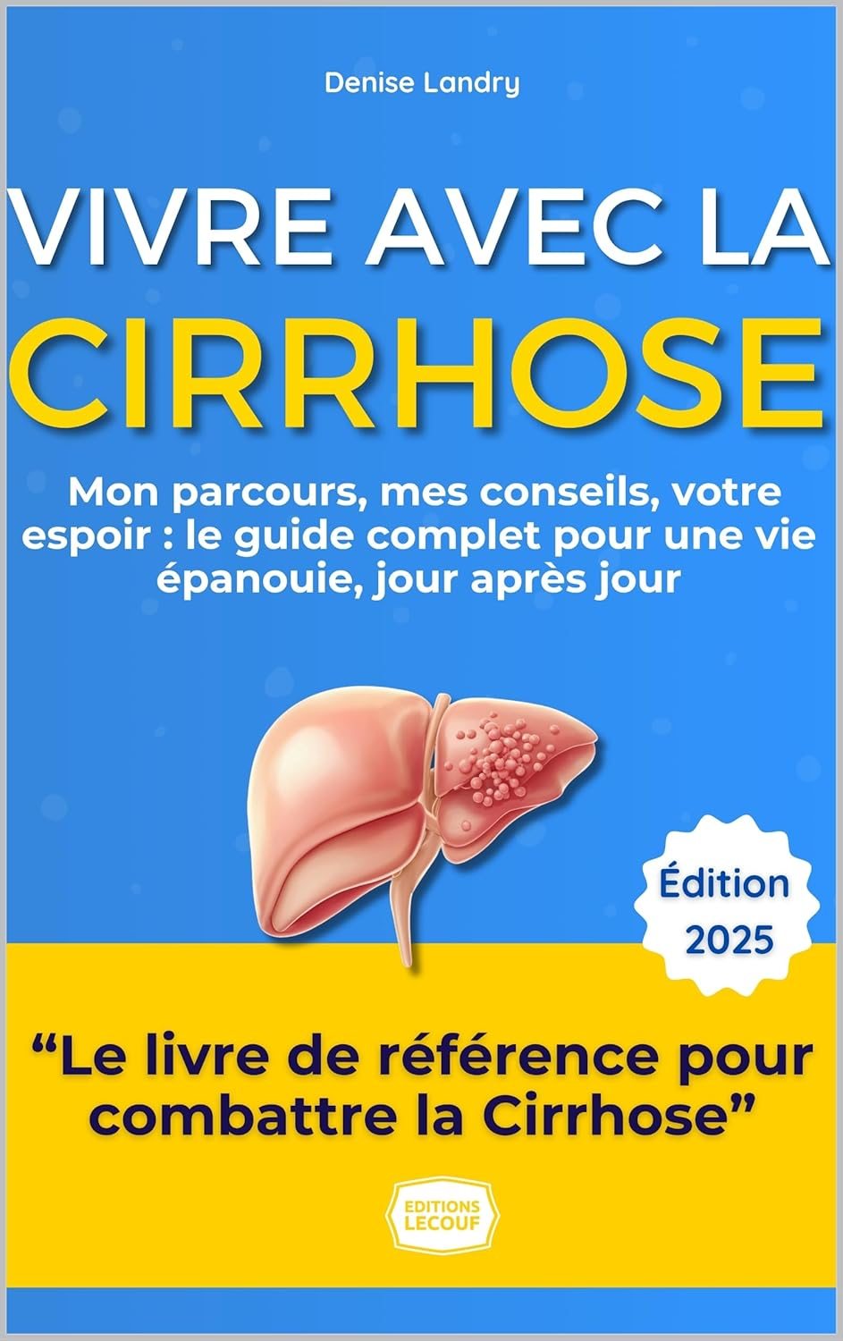 Couverture du livre Vivre avec la Cirrhose